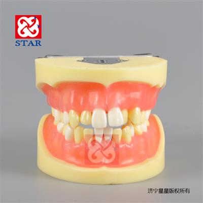 標(biāo)準(zhǔn)模型M8016可拔牙模型
